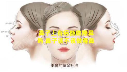 鼻子上有疤能做隆鼻吗 鼻子该不该做隆鼻